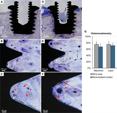 Long-term osseointegration of laser-ablated hearing implants in sheep cranial bone